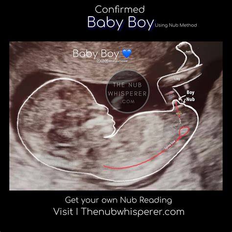 First time round I was convinced that I was carrying a boy. . How accurate is ultrasound gender prediction at 20 weeks